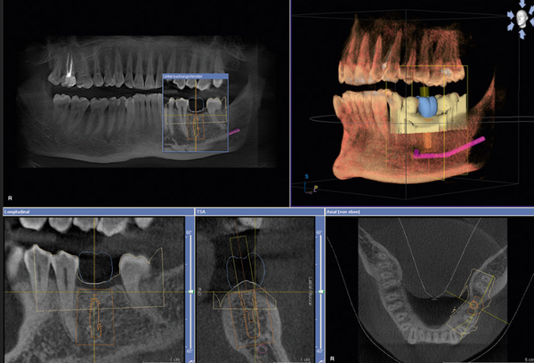 3DConeBeamCTScan