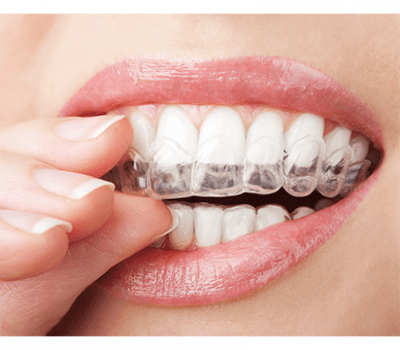 Whitening Trays
