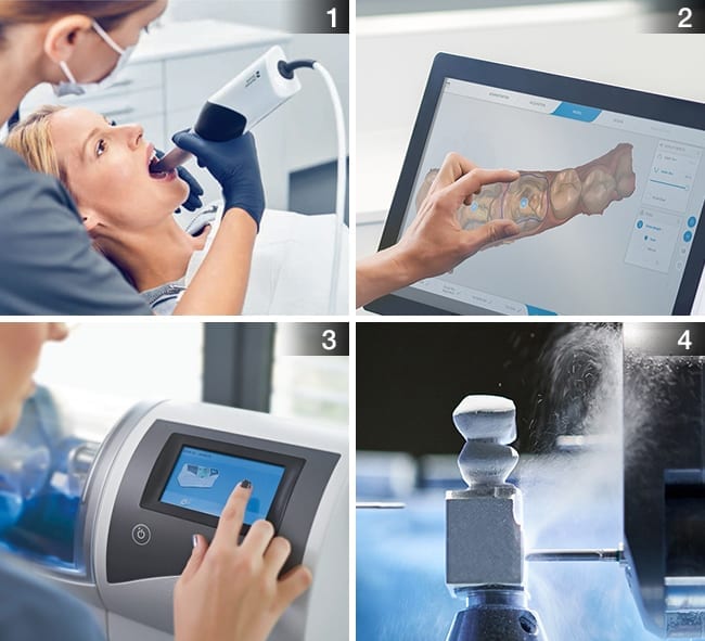 CEREC Procedure