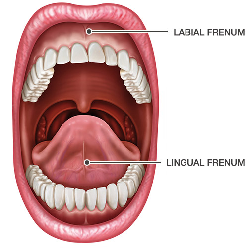 Lingual and Labial Frenums diagram