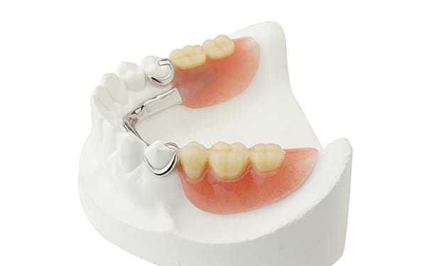 Partial denture