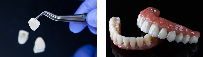 Cosmetic Dentistry